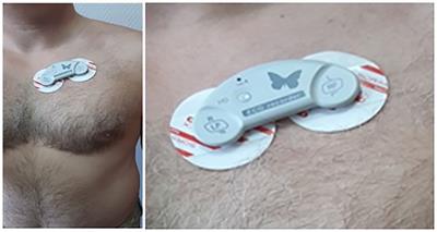 Assessment of the activities physiological cost of the defense forces officers in Ukraine using miniature ECG device